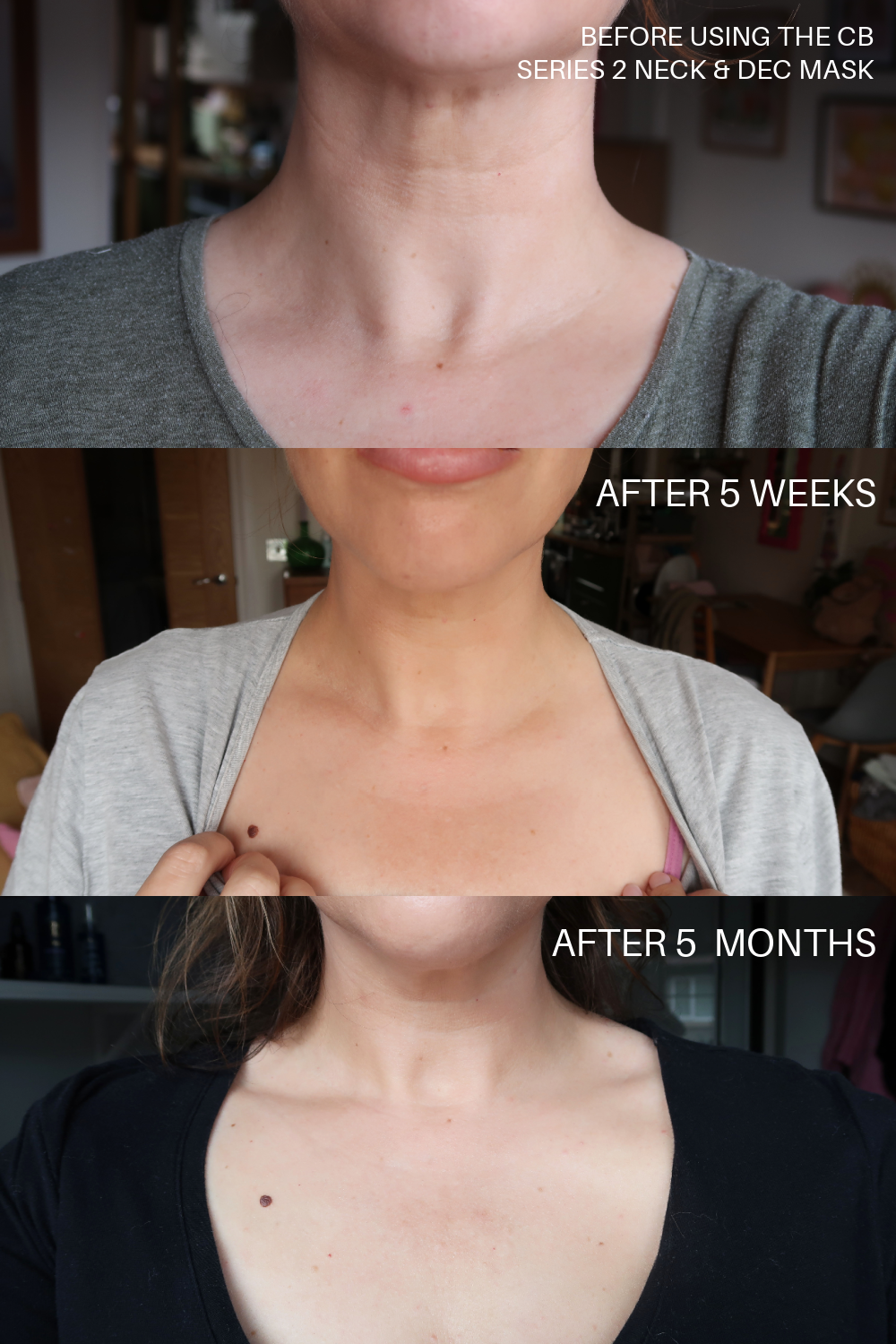 Currentbody LED series 2 neck mask results 6 months