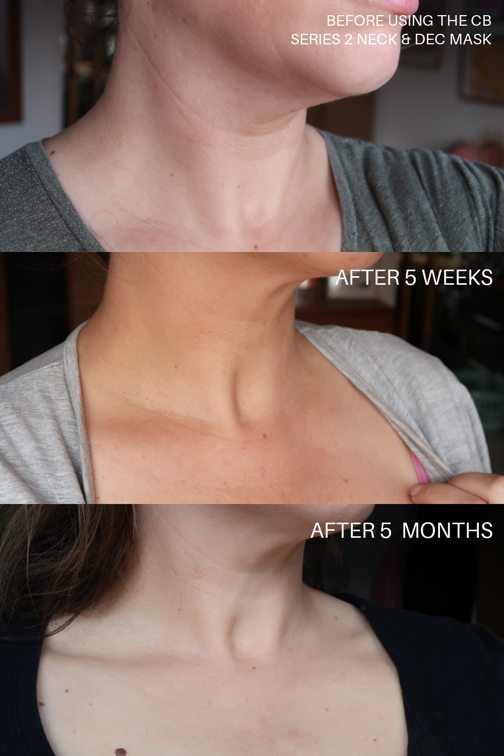 Currentbody LED series 2 neck mask results