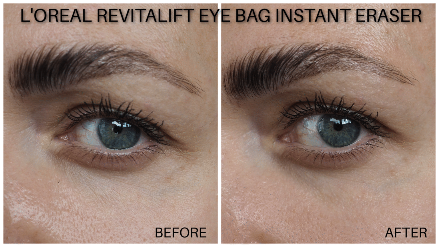 L’Oreal Eye Bag Eraser Review : Before & After’s on a 40+ skin - Laura
