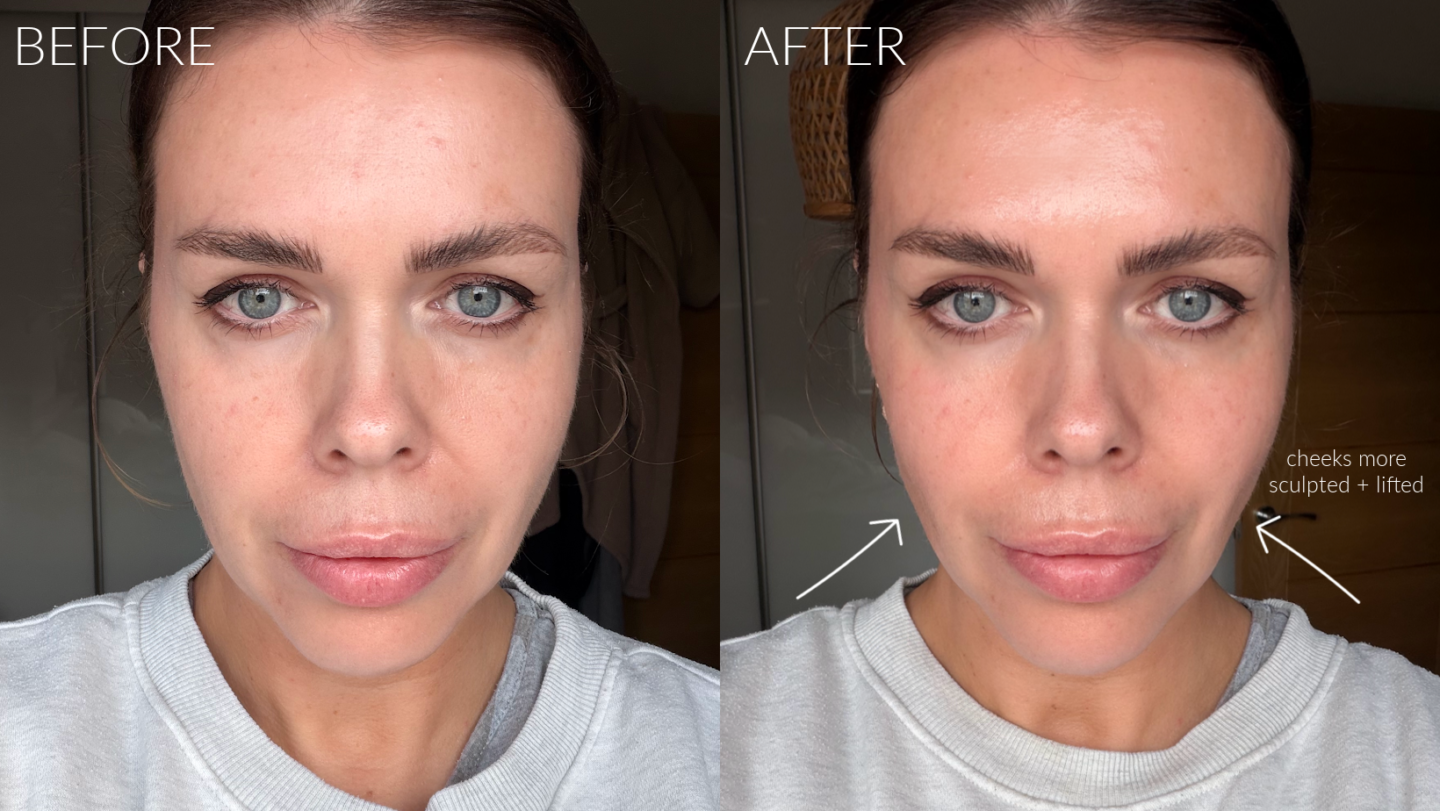 ZIIP Halo 2 review and before afters